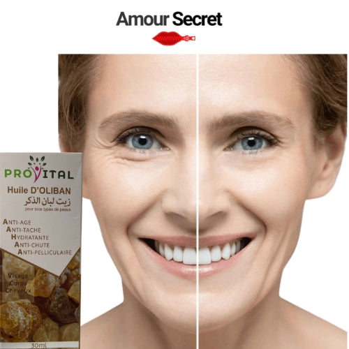 ProVital Huile d’Oliban – 30ml